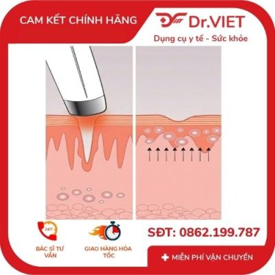 MÁY MASSAGE VẾT THÂM BỌNG MẮT EYE-200